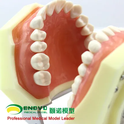 

JOURNAL OF STOMATOLOGY. Study on the preparation of gingival crevicular in vitro denture