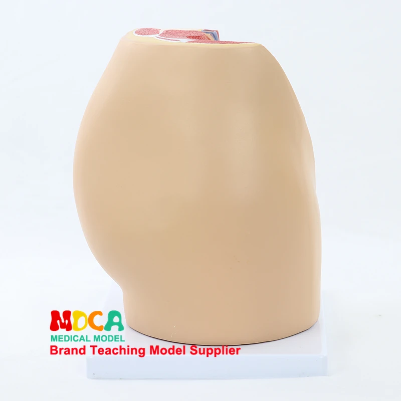 

MMNXT002 Model Medicine Teaching of Pelvic Median Sagittal Excision of Female Reproductive Pelvic System in Family Planning