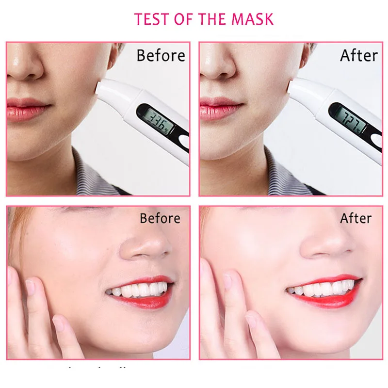 

10 pcs Fabric Face Care Oxygen Mask Removing Black Dots Whitening Plant Mask Moisturizing Oil Control Brightening Black Mask