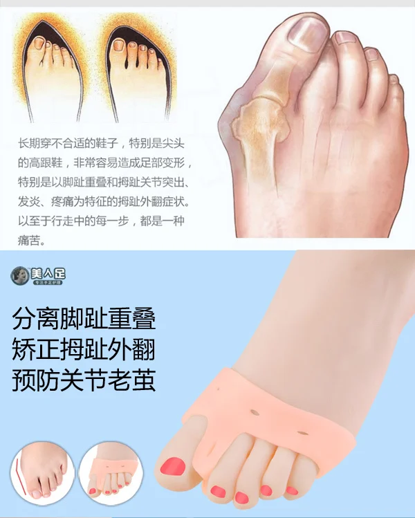 Биологический силикагель большого пальца ноги разделитель устройство для