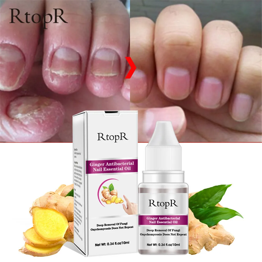 Антибактериальное средство для лечения Ногтей RtopR Ginger антигрибковое ногтей на