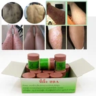 12 шт китайская мазь Psoriasi Eczma крем идеально подходит для все виды кожи проблемы патч 12
