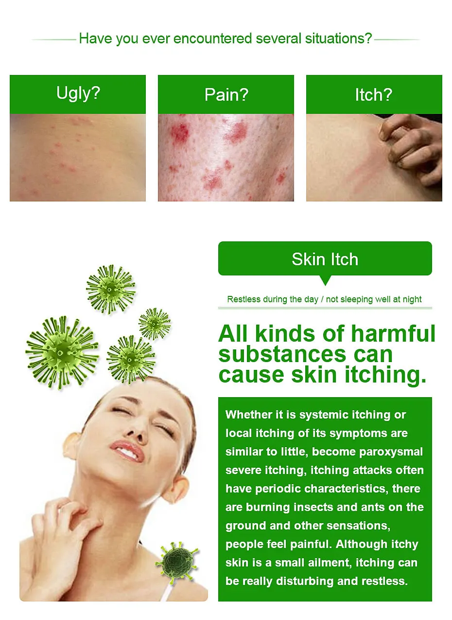 

5PCS YIGANERJING FOCALLURE Natural Chinese Medicine Herbal Anti Bacteria Cream Treatment Psoriasis Eczema Ointment Herble Cream