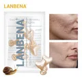 LANBENA ампульная сыворотка с гиалуроновой кислотой увлажняющая питательная легко впитываемая Антивозрастная укрепляющая для удаления морщин на 7 дней
