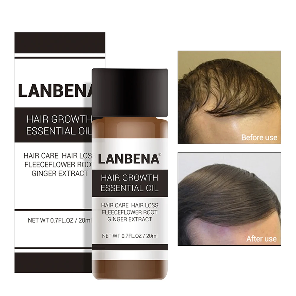 Быстрый мощный спрей для волос LANBENA + эссенция роста препятствующий облысению