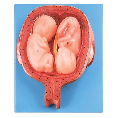 Five-month twin model Fetal development Gynecologist demonstrates simulation model natural size free shipping