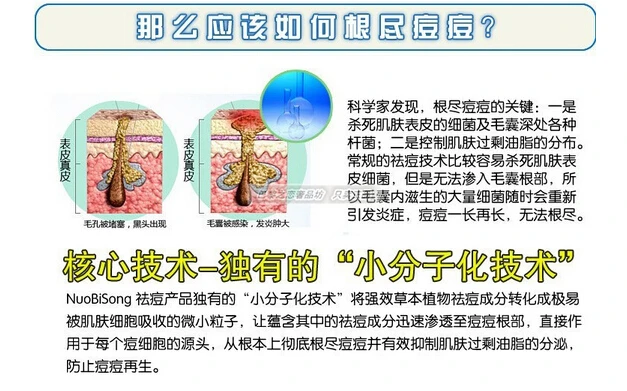 Горячее предложение! Распродажа! Nuobisong средство по уходу за лицом от прыщей удаления шрамов крем от прыщей и пятен уход за кожей лечение отбеливающий крем для лица растяжки увлажняющий