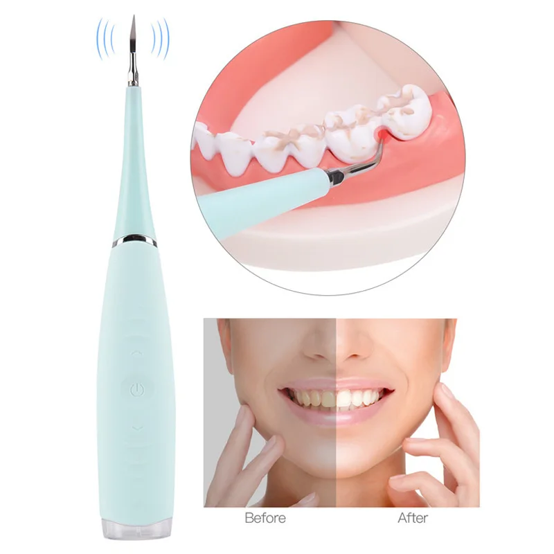 Стоматологический Электрический стоматологический аппарат для удаления зубных