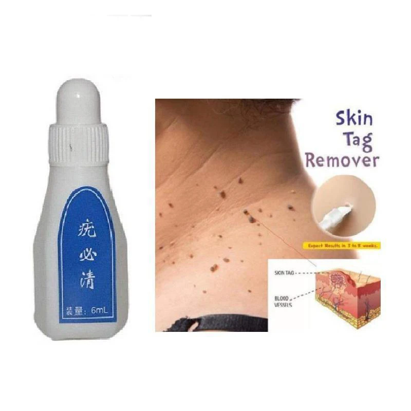 Новинка средство для удаления пятен и десен 12 часов Tu kill Remover бородавок сыворотка