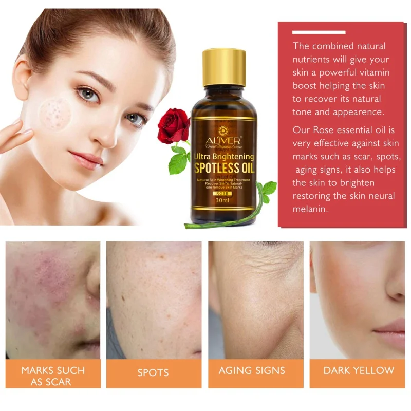 

Rose Essential Oils Splash Freckle Remove Anti Wrinkles Essence Oil Dark Blots Disappear Cleansing Face Serum