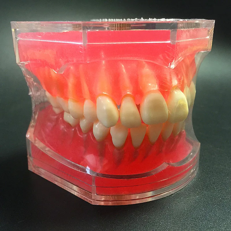 Обучающая модель для стоматологического обучения стандартная съемные | Стоматологическая учебная модель -32855450915