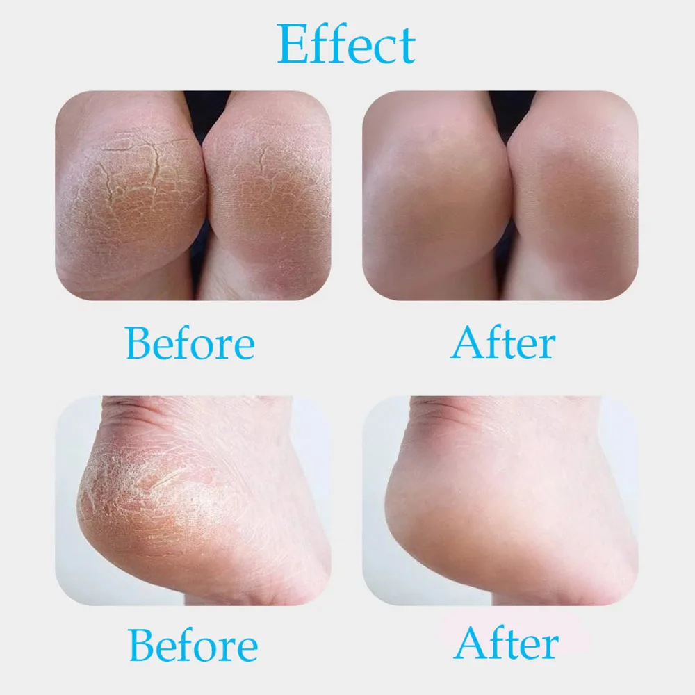 Профессиональный скребок для кутикулы инструмент ухода за ногами педикюр