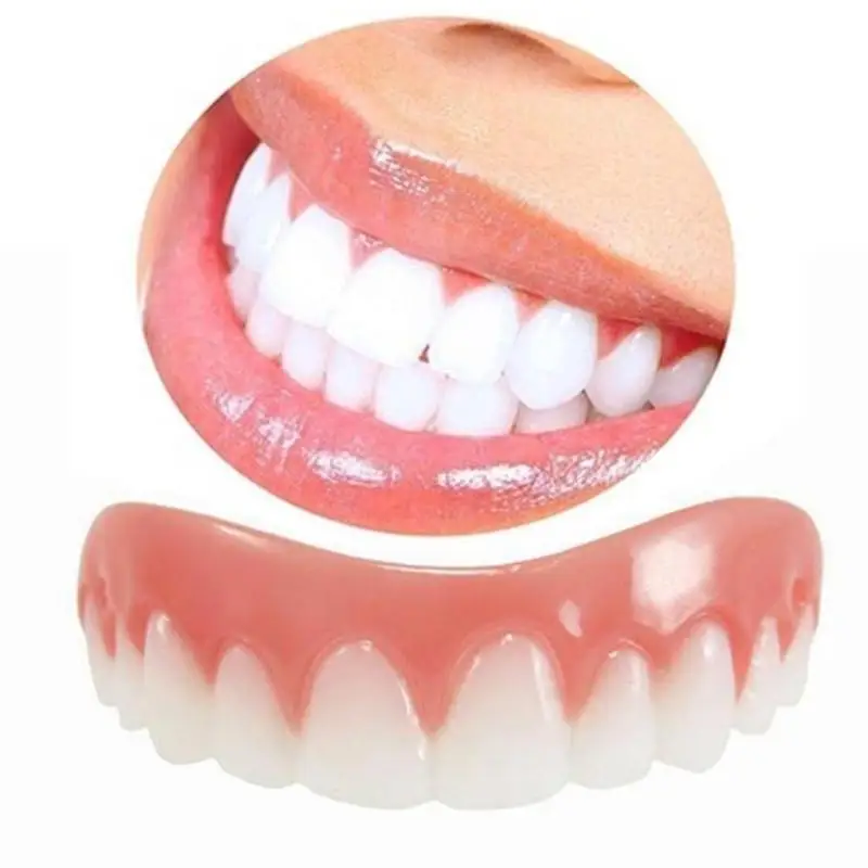 Smile комфорт верхние зубы шпон косметический | Красота и здоровье