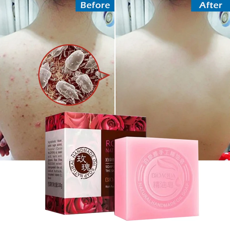 Мыло розы отбеливающая основа отбеливание кожи Kojic кислота ручной работы осветляющие прыщи, акне уход за лицом чистая ванна для мытья тела Savon L