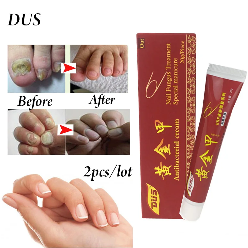 5 шт. пластырь для лечения грибка ногтей|Пластыри терапевтические| |