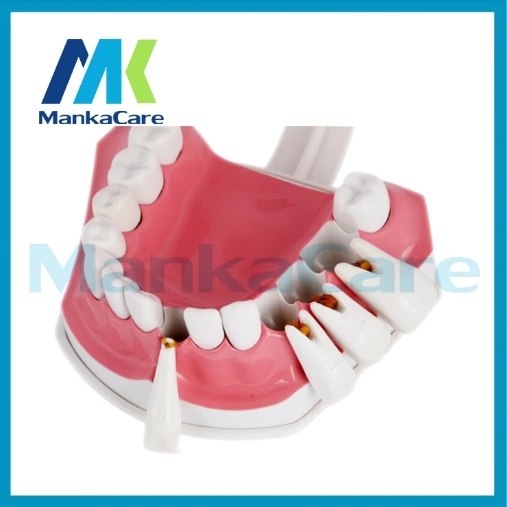 Manka Care-модель зубов для полости рта детей дошкольного возраста раннего обучения