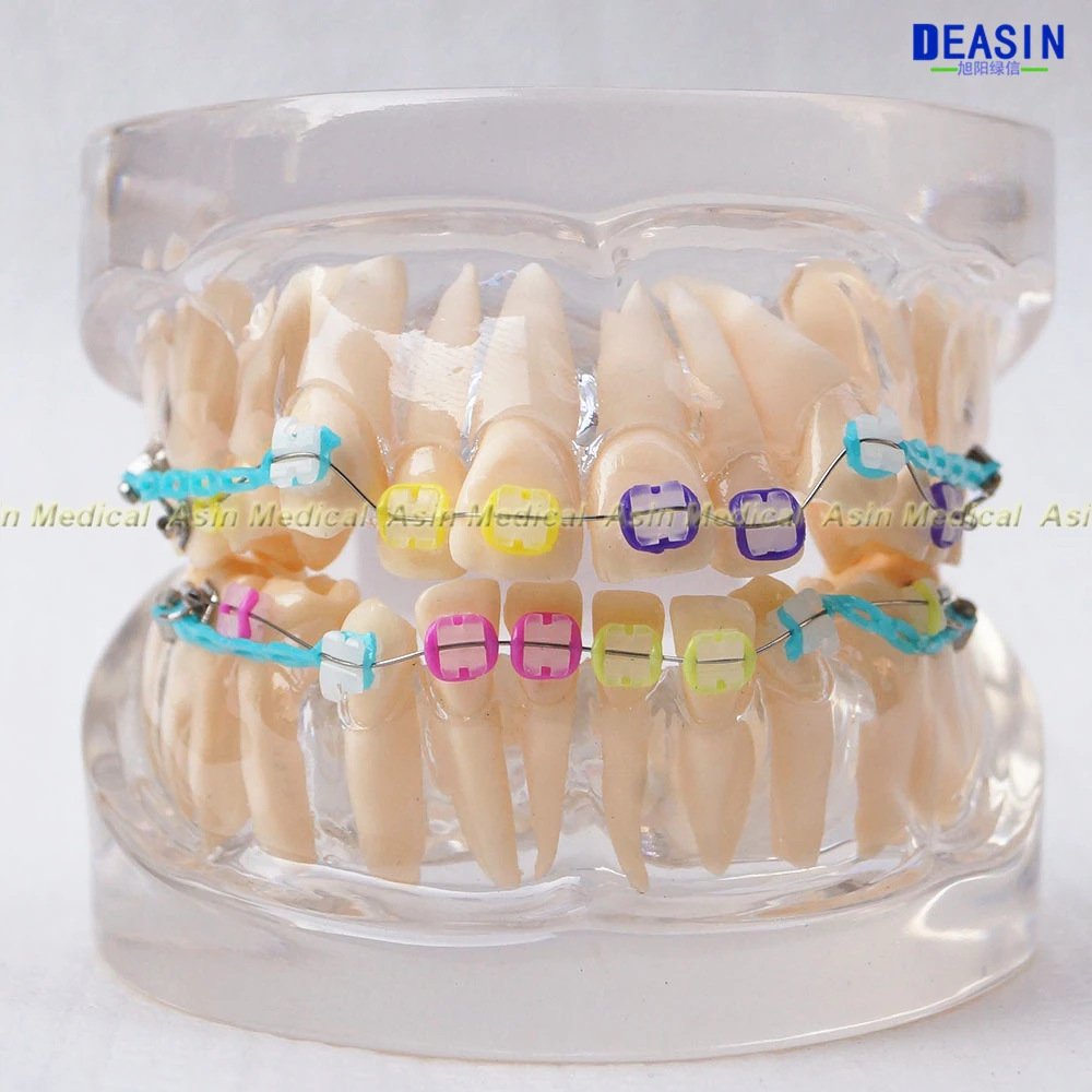 1 шт. ортодонт зубы модель с металлом и керамические кронштейны Ортодонтическая