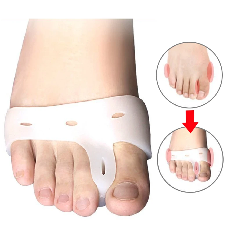 1pair style 8 Корректор вальгусной деформации, ортопедический корректор для педикюра, инструменты для педикюра, силиконовый корректор для ног, корректор для пальцев ног - Color: 1pair style 8