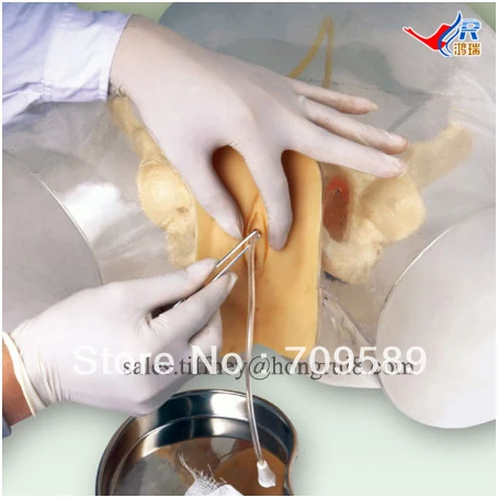 Усовершенствованная Прозрачная женская мочевая Катетеризация|female urethral