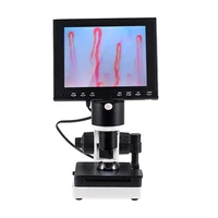 capillary microcirculation microscope magnification over 380 times
