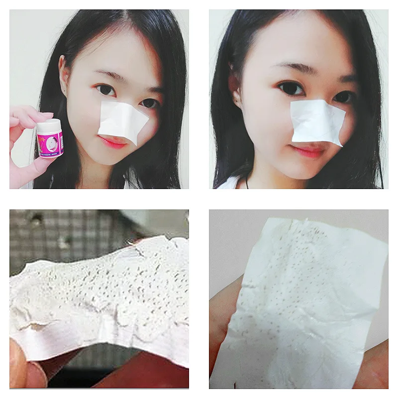 PIBAMY угрей и прибор для удаления прыщей маска носа стикеры грубой кожи Алоэ акне