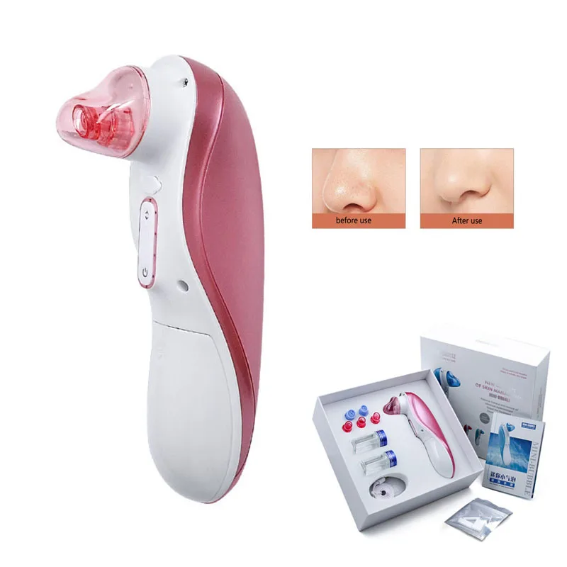 Электрический вакуумный экстрактор угрей циркуляционный мини-инструмент для