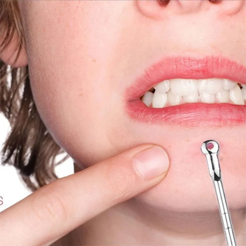 Набор инструментов для удаления прыщей и кодонов экстрактор с ложкой ухочистка