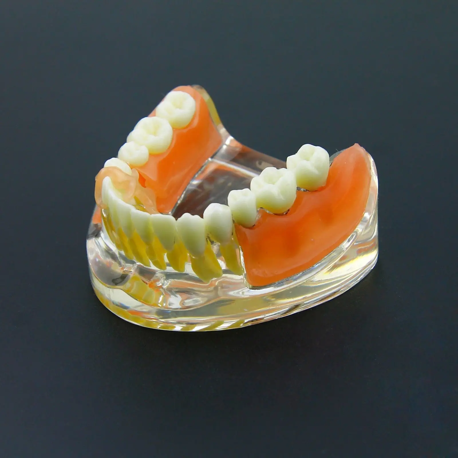 Акриловые зубные протезы отзывы и цены в москве