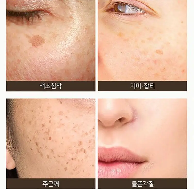 SOME BY MI Galactomyces Pure Vitamin C Glow Toner 200ml Facial Serum Care Acne Blackhead Freckles Removal Whitening Face Essence
SOME BY MI Galactomyces Pure Vitamin C Glow Toner 200ml Facial Serum Care Acne Blackhead Freckles Removal Whitening Face Essence