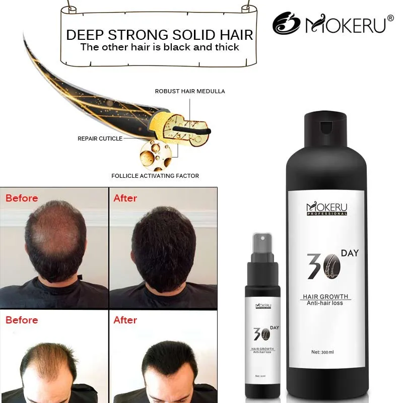 

Mokeru Professional Organic Castor Hair Growth Oil Liquid Spray Hair Regrowth Serum Oil Anti Hair Loss Products For Men Women