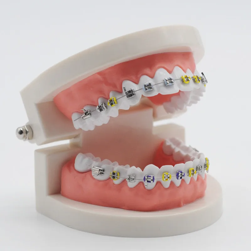 Лабораторная Ортодонтическая модель Орто металлический кронштейн Арка провод