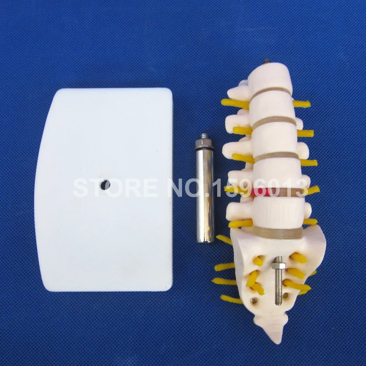 Мини поясничная модель позвонка с крестиком коциксом и грыжевым диском поясным