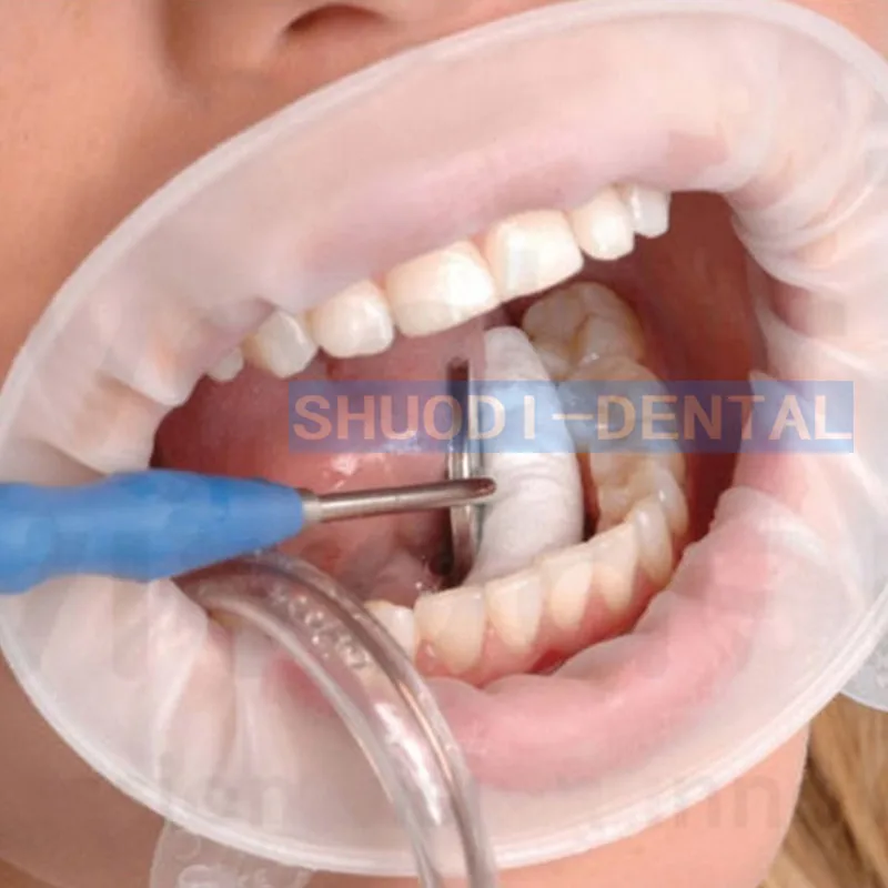 100 шт. Стоматологические Ортодонтические стерильные резиновые щеки Ретрактор