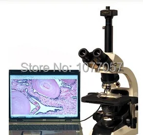 

Best sale 3.0M Pixel ,40X-1000X Infinity Digital Microscope for clinics ,Lab , Well sold In EU , USA , Latin American