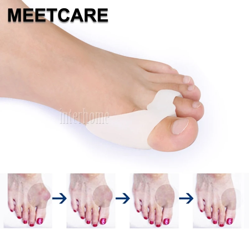 2 шт. силиконовые разделители большого пальца ноги | Красота и здоровье