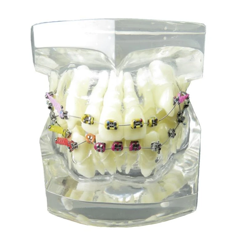 1 шт. прозрачная модель зубов Ортодонтическая цветная для обучения