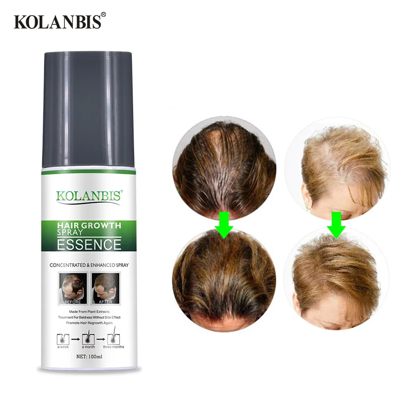 Сыворотка для быстрого роста волос густая долговечная полное масло Alopecia