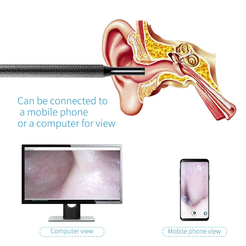 FREDI 3 в 1 USB медицинский эндоскоп камера 5 мм м мини ухо и нос Otoscope водонепроницаемый