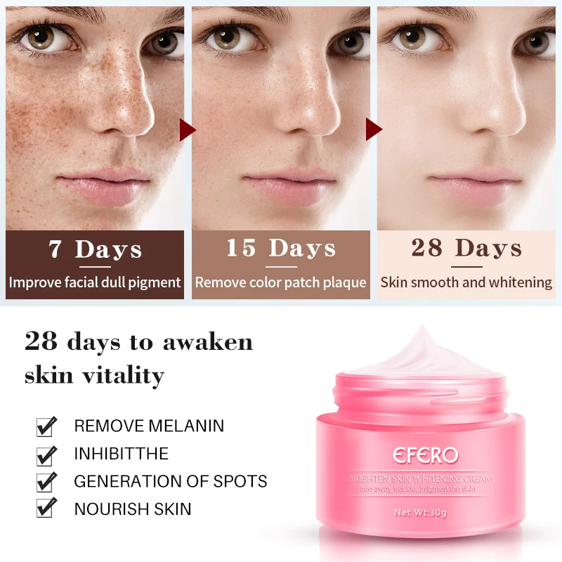 EFERO отбеливающий крем веснушки крем пигментация Melasma удаление Осветление кожи для темных пятен Manchas для удаления кремов для лица