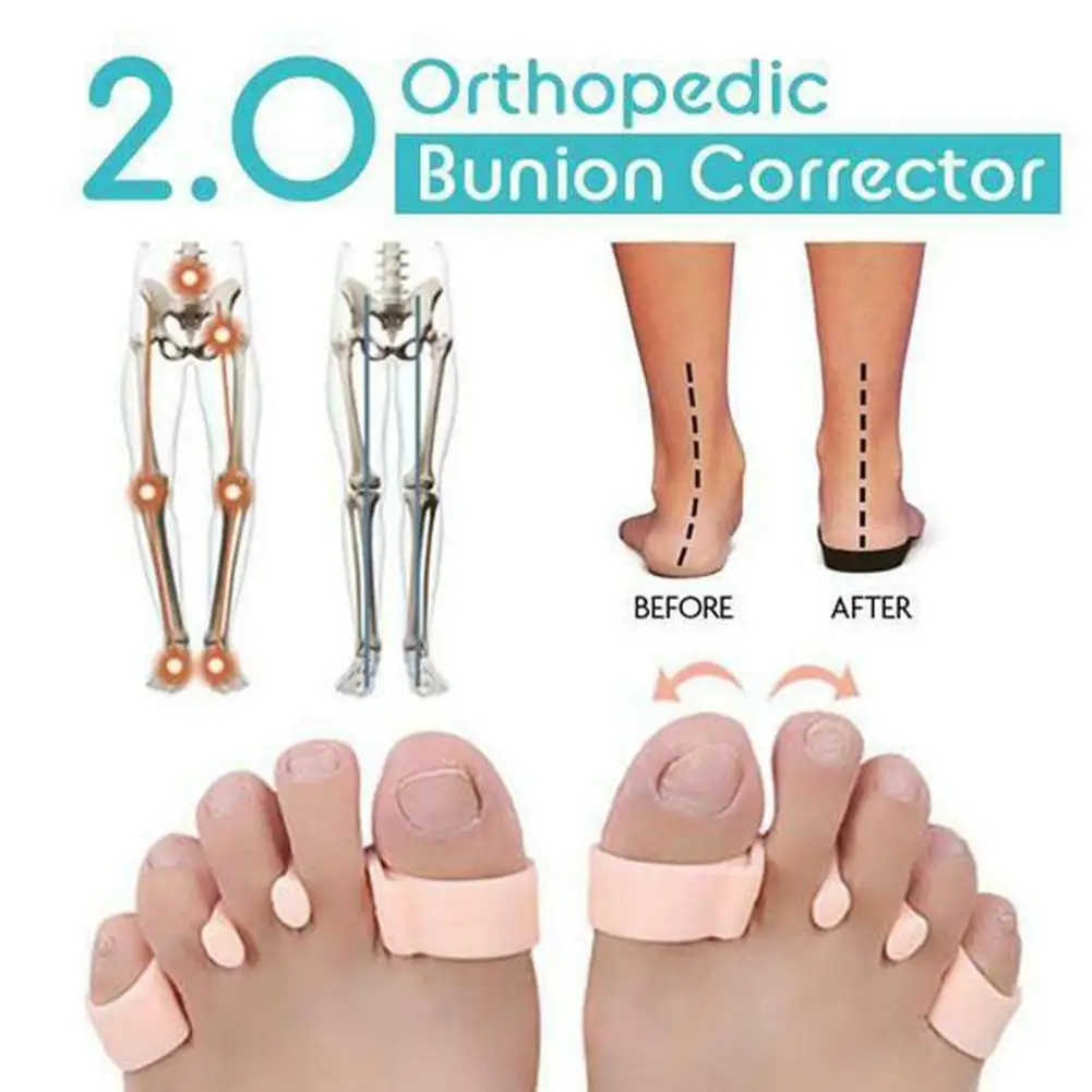 

1Pair Unisex Feet Orthopedic Bunion Corrector Overlapping Toes Separator Protector Feet Care Tools