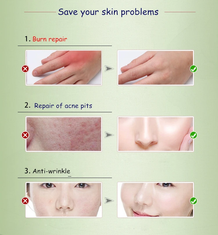 Dimollaure Eucalyptus эфирное масло для очистки воздуха ранка полезная простуды