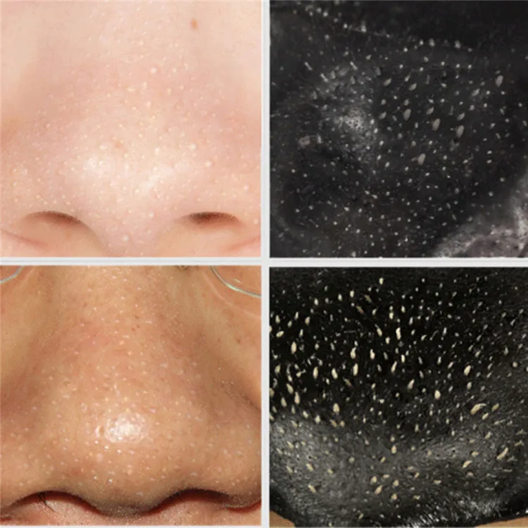 10 шт./лот маска для лица тушь удаления черных точек | Красота и здоровье