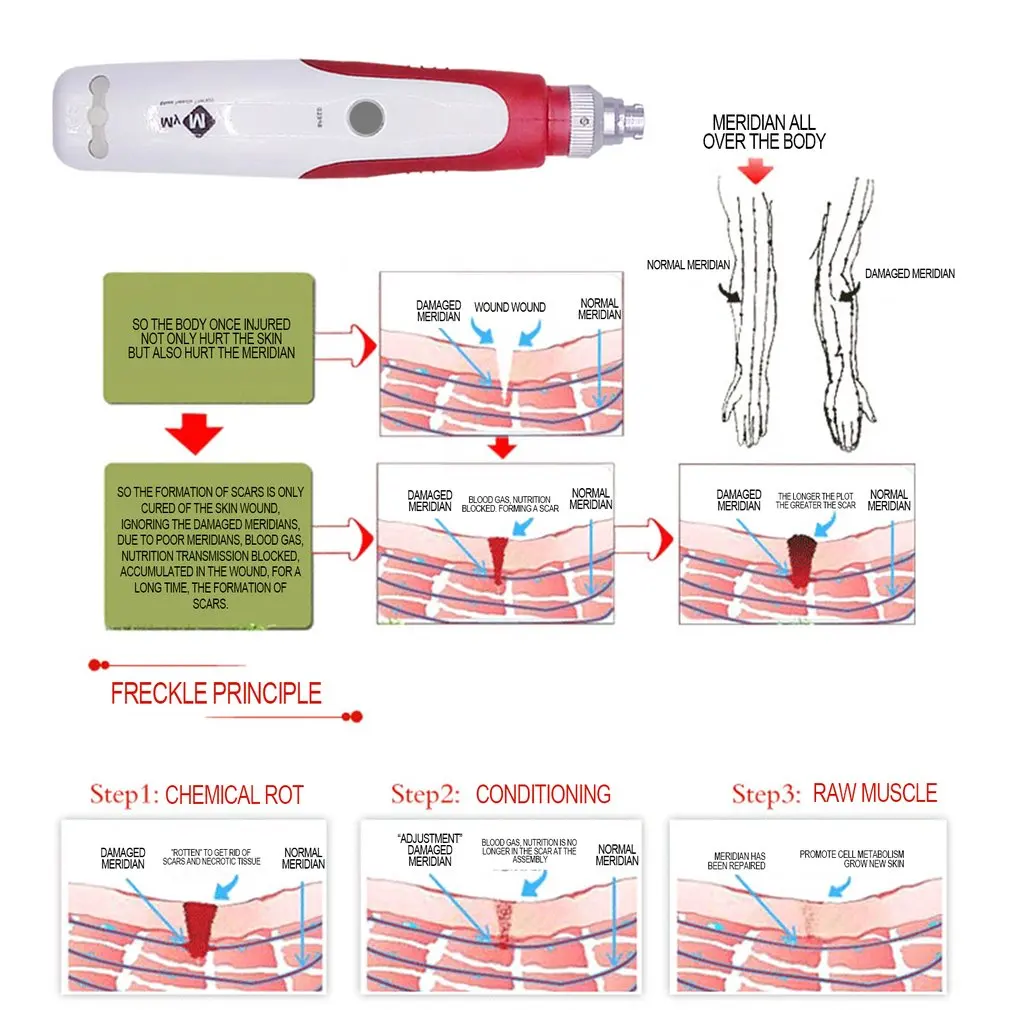 Derma Stramp электрическая Ручка Авто мезороллер анти старения кожи терапия для против морщин акне лечение дропшиппинг