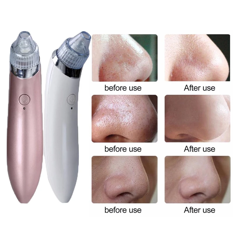 Алмазная дермабразия Blackhead пылесос всасывание удаление для постугревых рубцов
