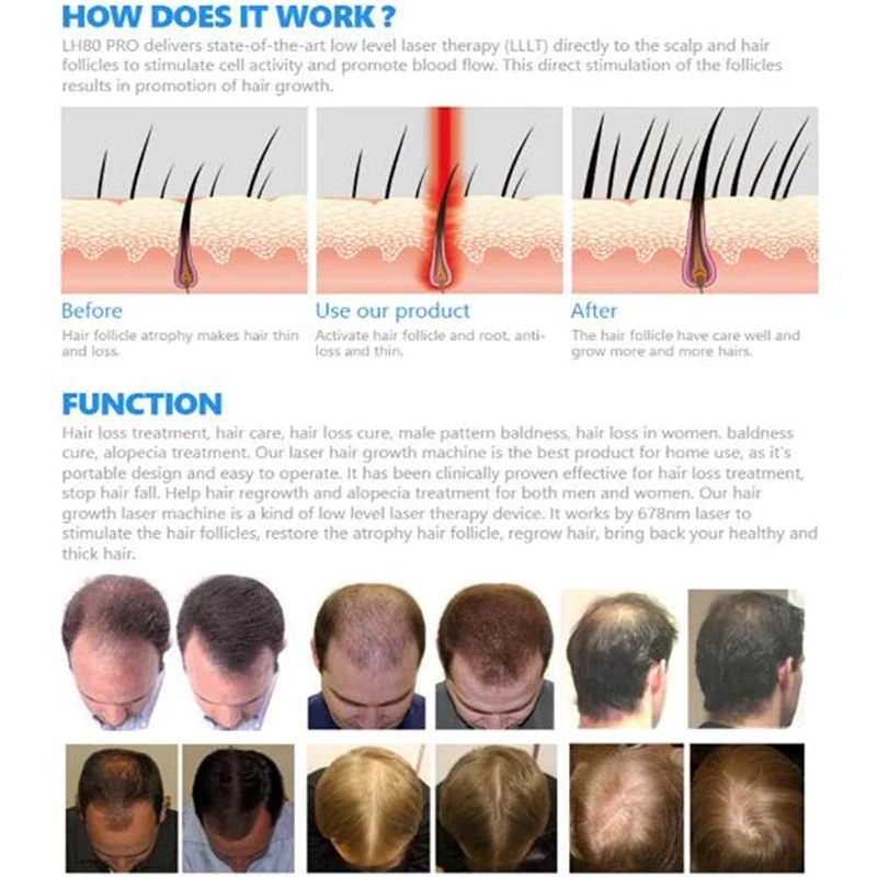 

Hair LED Regrowth Rejuvenator Anti-Hair Loss Cap Hair Growth Helmet Stimulate Hair Follicle Regeneration