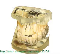 Бесплатная доставка модель необычной (10 шт. * 1 комплект) модели ортодонтических