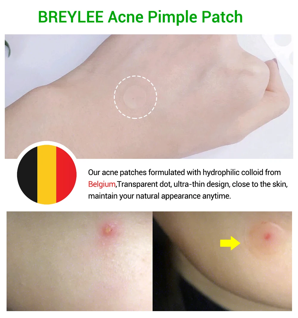 BREYLEE прыщи, прыщи, наклейки для лечения прыщей, средство для удаления прыщей, пятна, уход за кожей, маска для лица, крем от прыщей, ежедневное использование