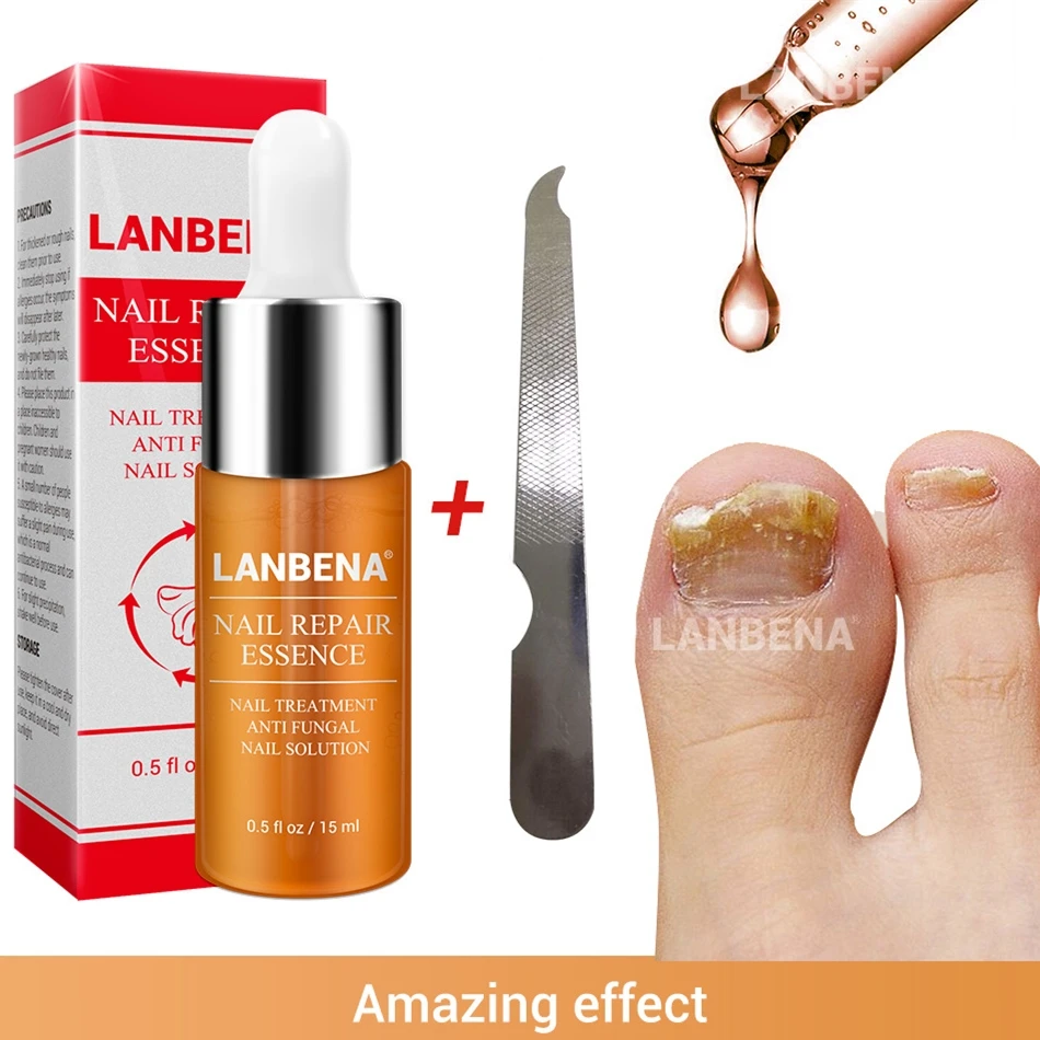 2pcs LANBENA Nail Repair Essence Serum Toenail Fungus Treatment Fingernails fungus Remove Onychomycosis Cuticle Removal Oil |