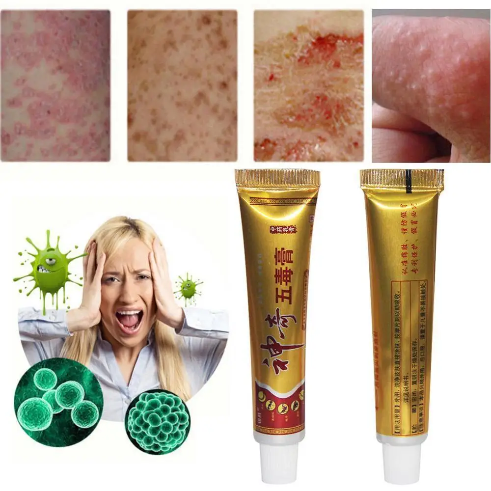 

3PCS Yiganerjing Eczema Ointment Treatment Psoriasis Cream 15G Wholesale