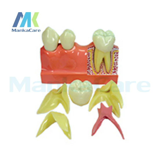 Manka Care -  4Times Disassembling/Imported resin teeth/Imported quartz rubber plate Oral Model Teeth Tooth Model